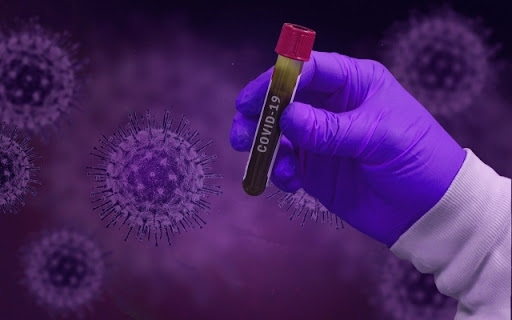 Már 17,6 millió a koronavírus-fertőzöttek száma, a halálos áldozatoké 679 ezer